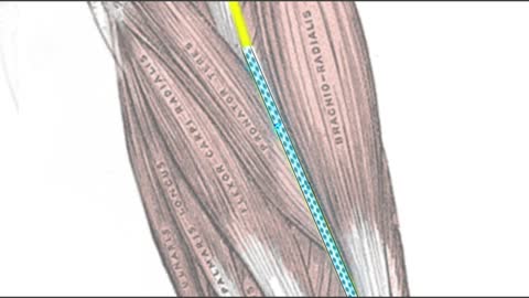 In a Nutshell: Understanding the Acupuncture Channels