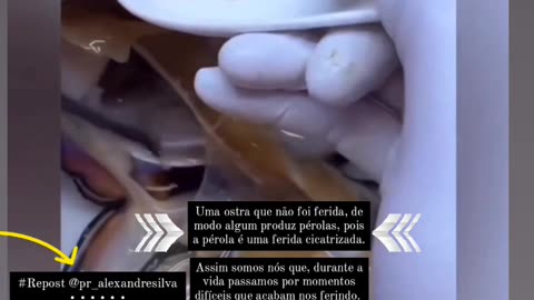 Quantas pérolas existem dentro de você?