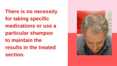 Hair Transplantation in Melbourne- HC International