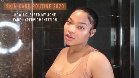 Transformed in 7 Days: Watch How This Girl Achieves Clear Skin and Conquers Acne!