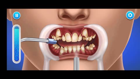 ASMR VIDEO | animated video of teeth treatment