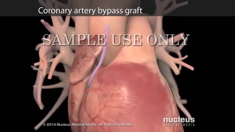 Treatment Options for Heart Failure Nucleus Health