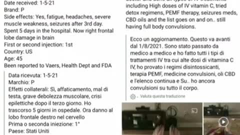 Vaccine COVID effect 11 - Effetti dei vaccini COVID " Legs epilepsy "