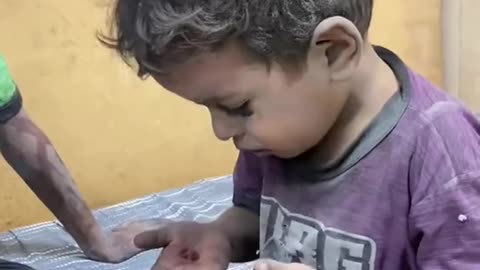 Terrified Child Shakes After Injury from Israeli Bombardment in Gaza City
