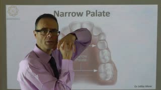 A Narrow Palate By Dr Mike Mew