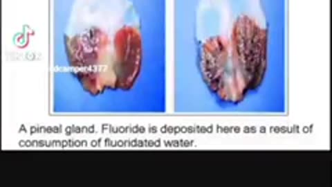 Fluoride