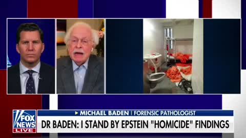 A forensic pathologist gives his analysis on whether or not Jeffrey Epstein killed himself