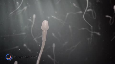 Sperm collection