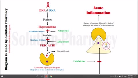 Gout- Pathophysiology of Gout via Animated Presentation -HINDI- By Solution Pharmacy