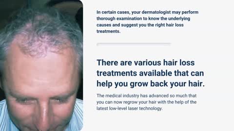 Hair Loss Solutions in Melbourne- HC International