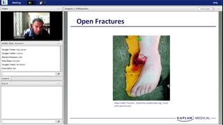 17th_Lecture_Kaplan_Step_2_CK_CA