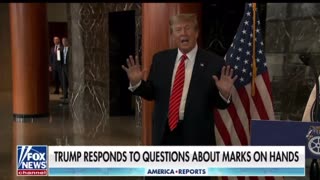 Trump on Red Marks on his Hand - Maybe it was AI