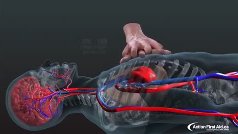 How to pump blood to the brain. Life-saving technique