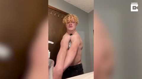 Man Born Without Collar Bones Can Clap His Shoulders