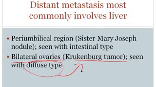 Stomach Diseases