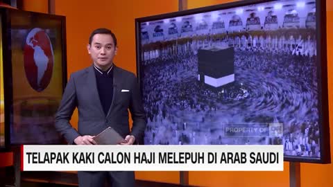 Telapak Kaki Calon Haji Melepuh di Arab Saudi