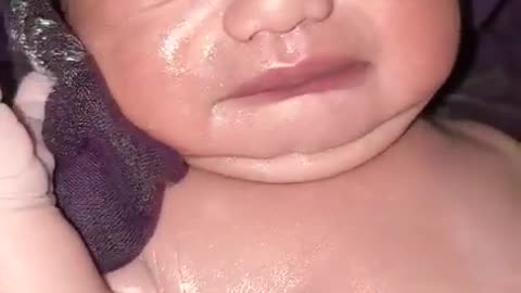 Cleaning process of new born baby after birth cry hard 😱😭