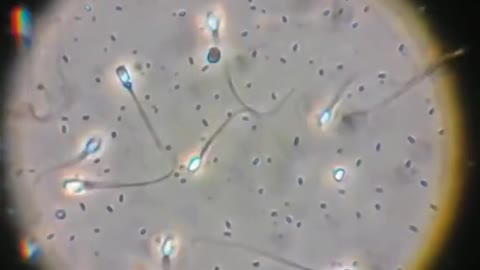 Sperm under microscope