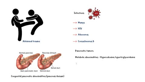 What Causes Pancreatitis _Most Common Causes Of Pancreatitis
