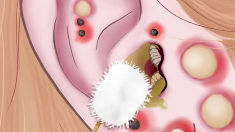 awareness video#cleaning girls ear# hygenic video# be aware