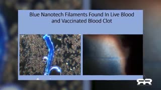 NANOTECHNOLOGY FOUND IN BOTH VAXXED AND UN-VAXXED