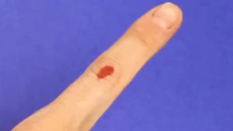 How to effectively apply bandage to the joint of a finger