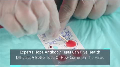 Antibody Test | covidexpresscare.com | +12244703884