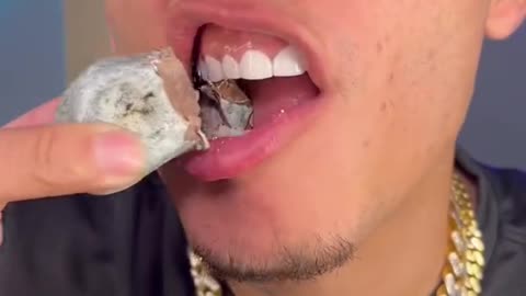 I bit into a ROCK after getting $10k teeth!