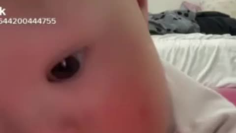 Trump Said This Baby Was The Cutest Pin Head He Has Ever Seen LOL Watch This!