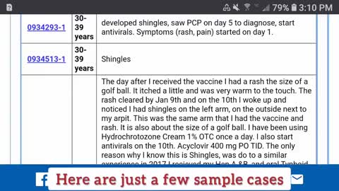 REVEALED !! WHAT DID I FIND WHEN SEARCHING VAERS COVID INJECTIONS INVOLVING "SHINGLES?" !!