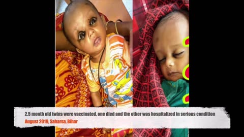 10 instances of twins harmed by routine vaccination | India's Forgotten Babies