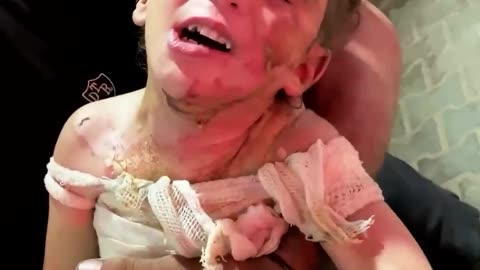 The child, Sumaya Al-Araj, was injured in an Israeli bombing that targeted their house