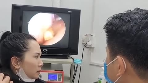 Doctor Removes Something Stuck in Nose!