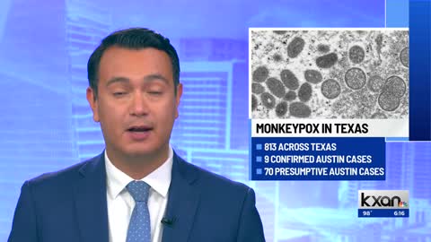 How Austin-Travis County EMS is responding to monkeypox calls