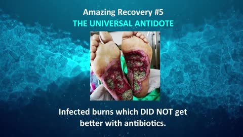 Five Amazing Recoveries With THE UNIVERSAL ANTIDOTE
