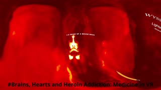 #Brains, Hearts and Heroin Addiction Medicine in VR