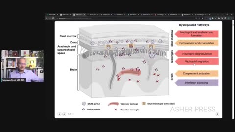 Spike Protein Accumulates in Brain and Skull and Causes Damage - Dr Mobeen Syed