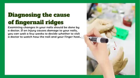 Finger Nails Ridges and Diabetes
