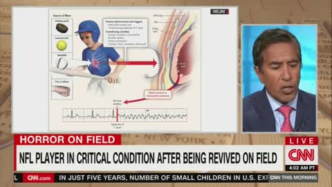 CNN's Dr. Sanjay Gupta on Damar Hamlin