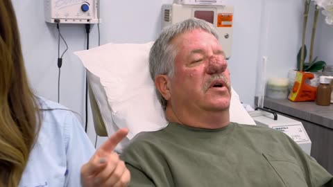 Dr. Lee Transforms Patient's Hugely Overgrown Nose I Dr. Pimple Popper Pop Ups