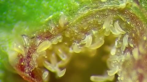 Leaf Mites Under Microscope (Bladder Gall Mites)