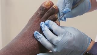 How medical procedures transform feet