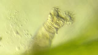 Microscopic Rotifer Spins Cilia