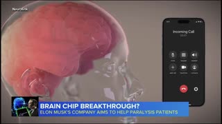 NEURALINK BRAIN CHIP TRANSPLANT! THIS ISN'T REALLY THE 1ST!