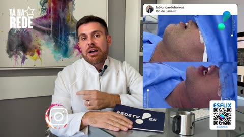 Dr. Fabio Barros fez uma matéria sobre Prótese Facial - PGM 065