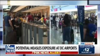 Contagious measles ???