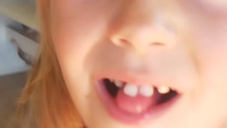 Losing two front teeth