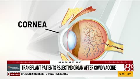 Corneal Graft Organ Rejection After COVID-19 Vaccination