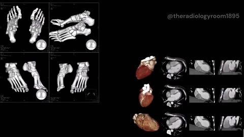 How Does a CT scan work.