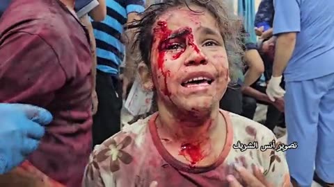 A wounded girl in Gaza, after giving a kiss to the camera